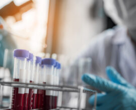 FHPMCO-Virus-Sida-MST-VIH-Science-Santé-recherche