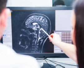 FHPMCO-Santé-IA-Tumeur-Cerveau-Cancer
